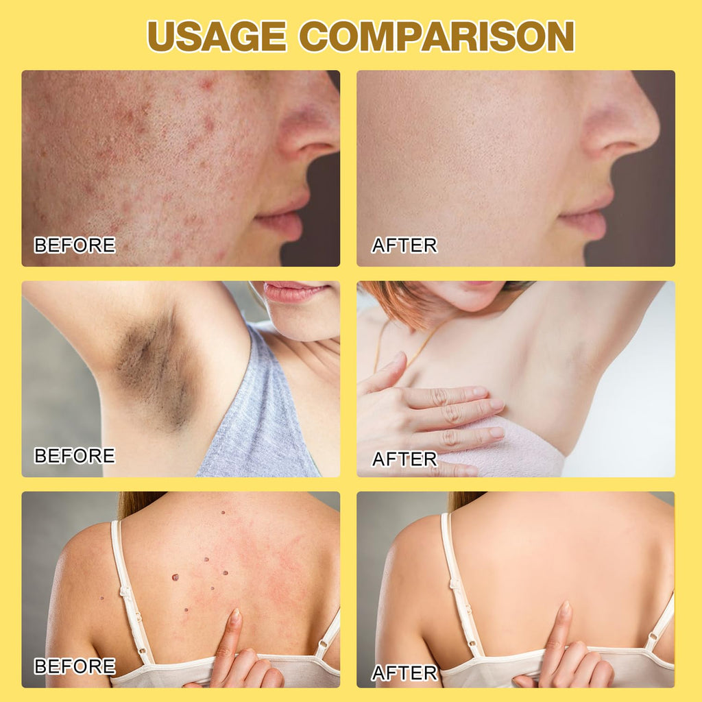 MyClinic™ Bee Venom Cream | Repairs your skin in 24 hours!